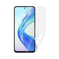 Screenshield HUAWEI Honor X7b fólie na displej Screenshield HUAWEI Honor X7b fólie na displej