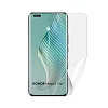 Screenshield HUAWEI Honor Magic 5 Pro fólie na displej