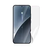 Screenshield XIAOMI 15 5G  fólie na displej