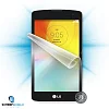 Screenshield™ LG D390N F60 ochrana displeje