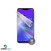 Screenshield ASUS Zenfone Max M2 ZB633KL folie na displej